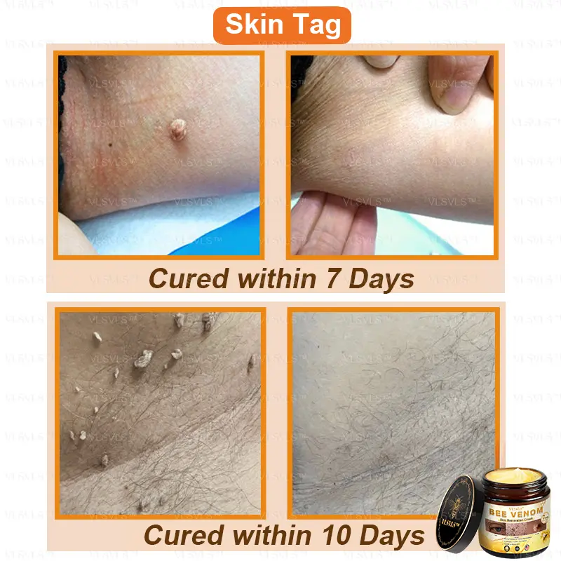 Winter Sale Bee Venom Skin Restoration Cream - Image 3