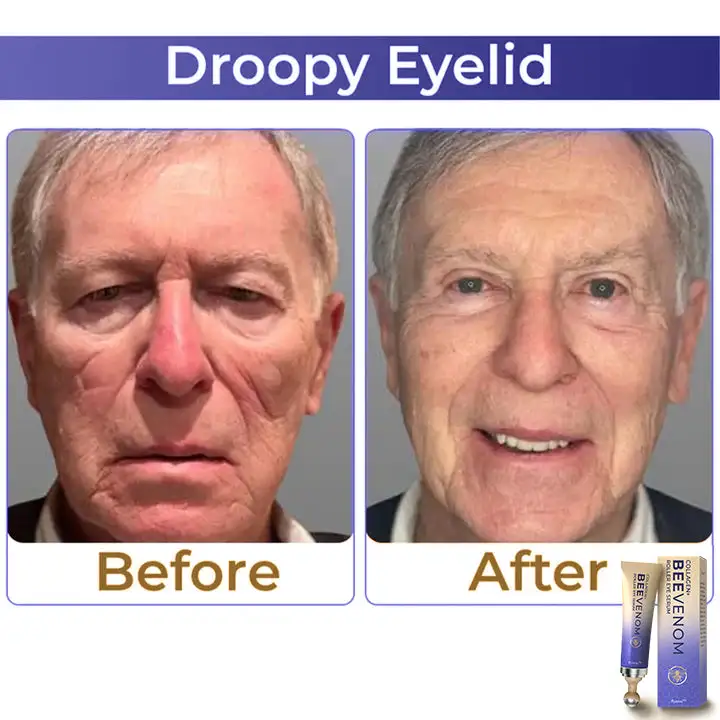Collagen+ Bee Venom Roller Eye Cream - Image 3