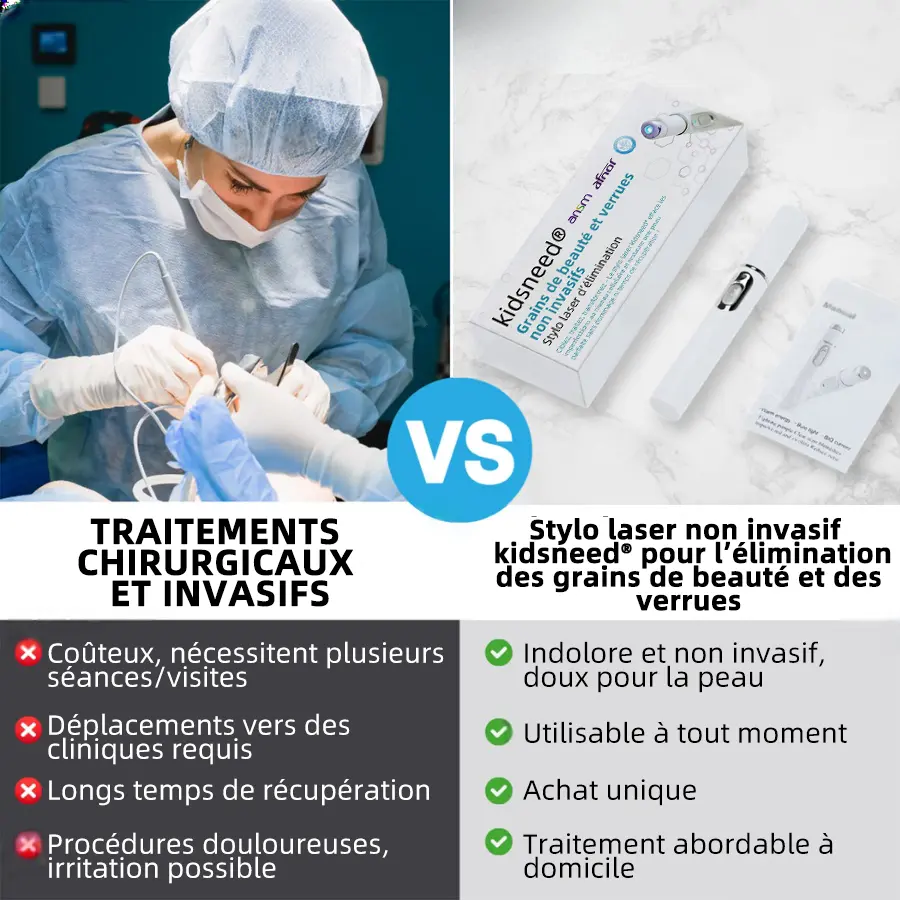 Grains de beauté et verrues non invasifs Stylo laser d'élimination - Image 10