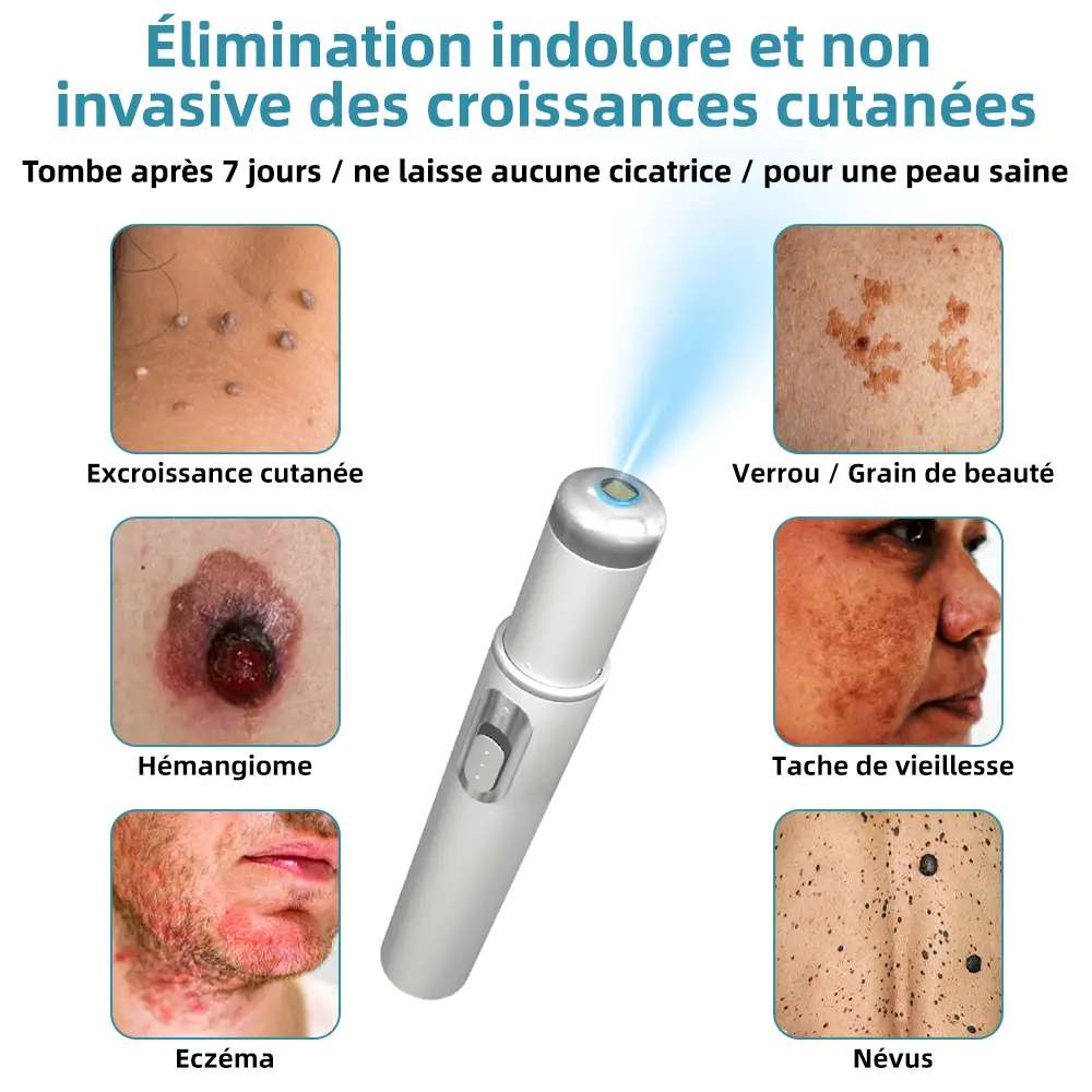 Grains de beauté et verrues non invasifs Stylo laser d'élimination - Image 2
