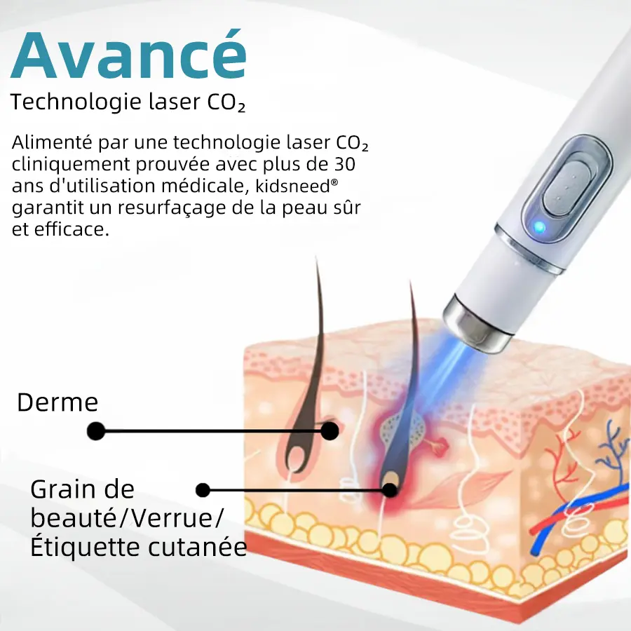 Grains de beauté et verrues non invasifs Stylo laser d'élimination - Image 8