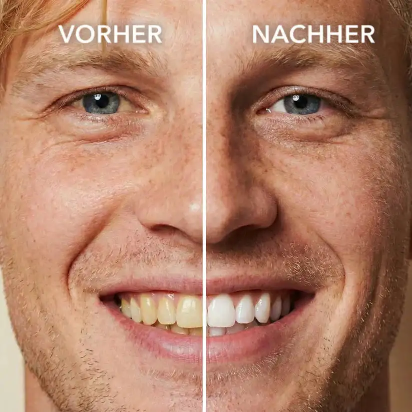 Tooth Polish - Instant Clean Smile - Image 2