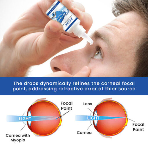 Myopia Eye Cure Drops - Image 6
