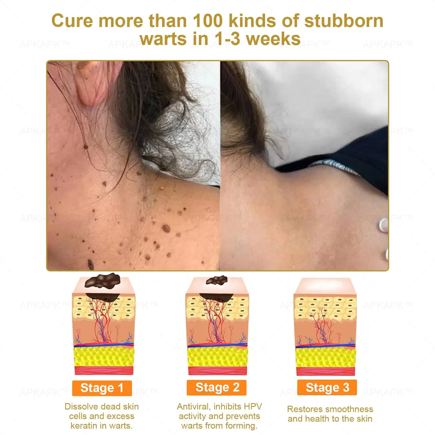 Effective All-in-One Skin Treatment Cream - Image 5