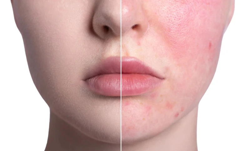 ATTDX Color Correcting Treatment Cream - Image 2