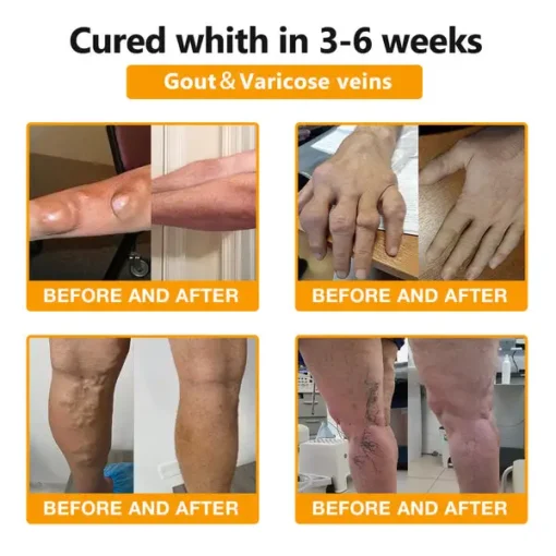 Bee Venom & Turmeric Arthritis Therapy Cream - Image 6
