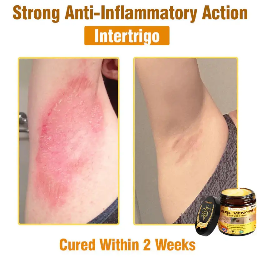 ๐๐๐ ๐๐๐ง๐จ๐ฆ ๐๐ฅ๐ฅ-๐ข๐ง-๐๐ง๐ ๐๐ซ๐๐๐ฆโAnti-Aging, Hydrating & Skin Repair - Image 12
