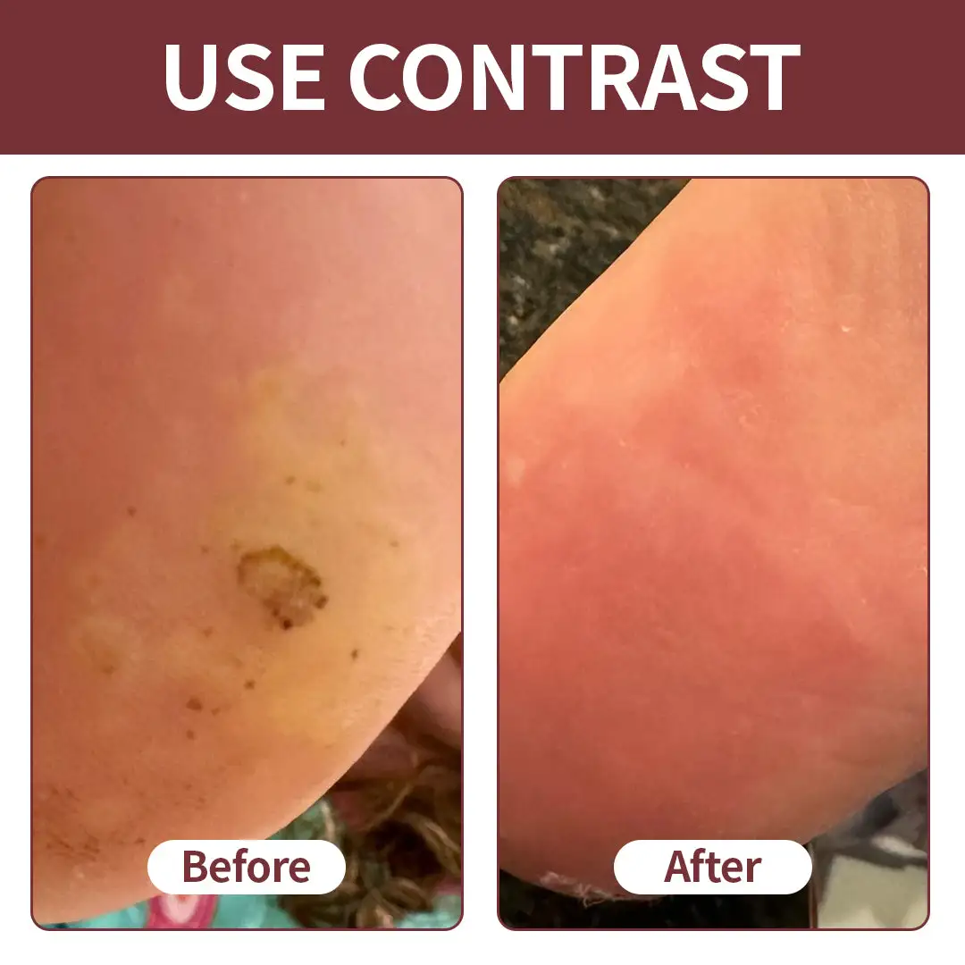 KeraErase Dual-Action Renewal Cream - Image 3