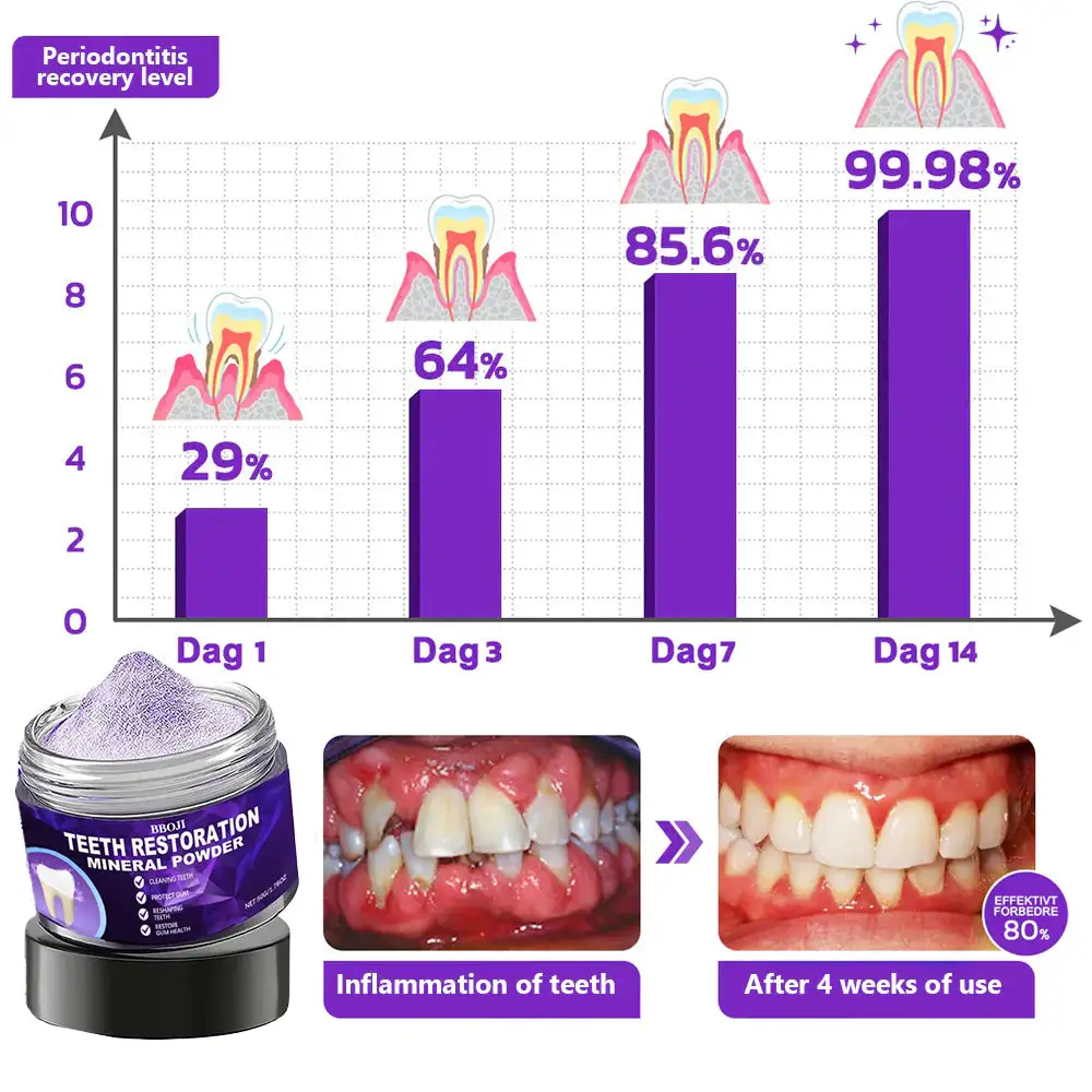 Teeth Restoration Mineral Powder - Image 4