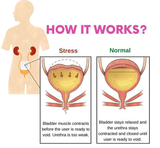 Bladder Control Patch - Image 6