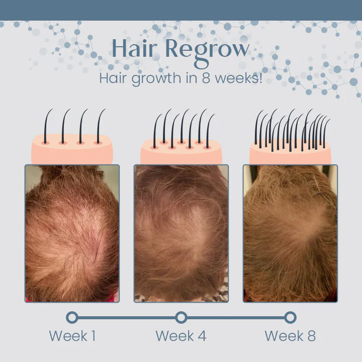 Root Renew Nourishing Hair Scrub - Image 5