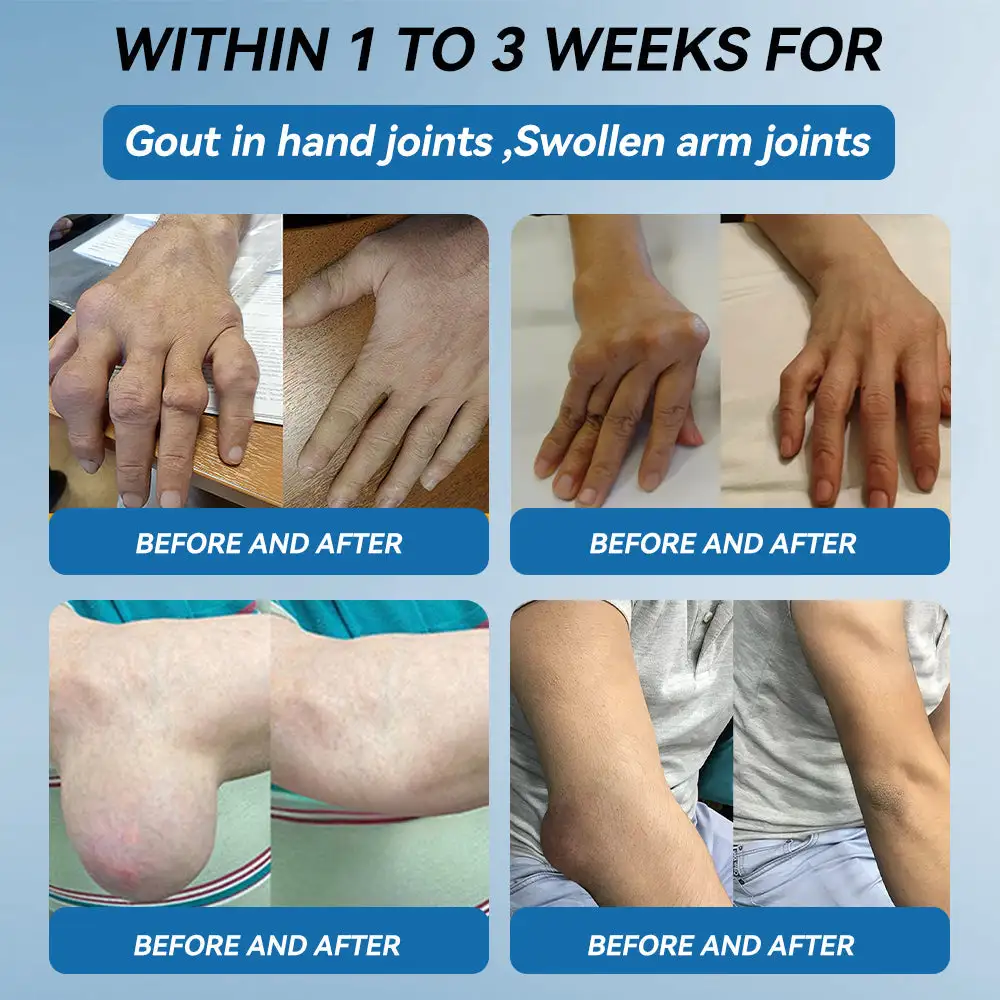 ʙ.ᴘ.ᴄ-157 Joint Healing Cream - Image 15