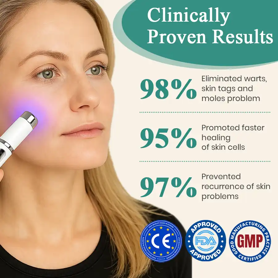 LumeSkin Mole and Wart Instant Removal Laser Pen ACE 4 - Image 4