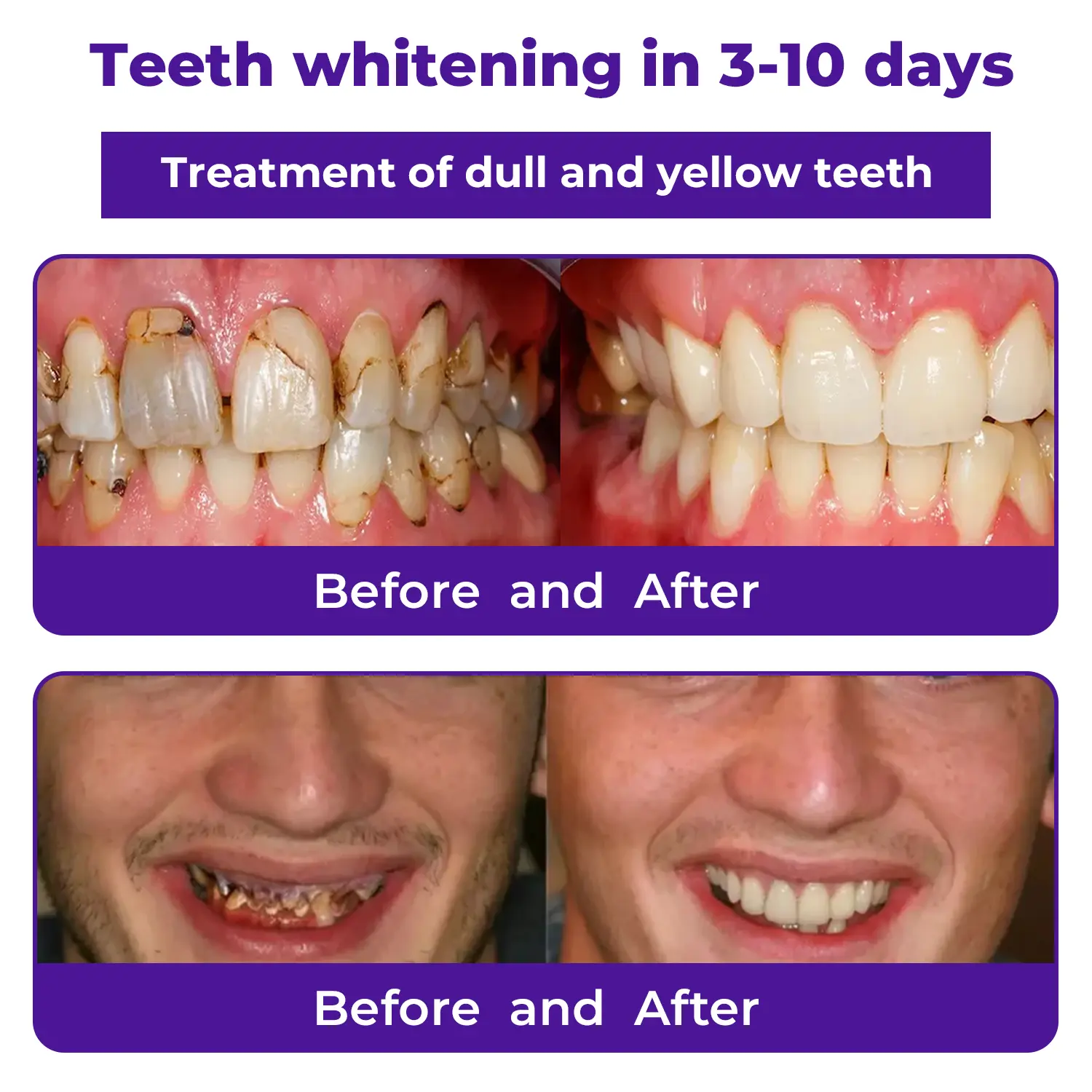 Dental Repair Mineral Powder - Image 3
