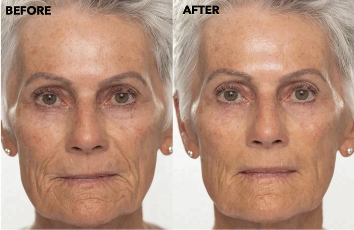 Double Retinol & Collagen Peptide Serum Treatment - Image 2