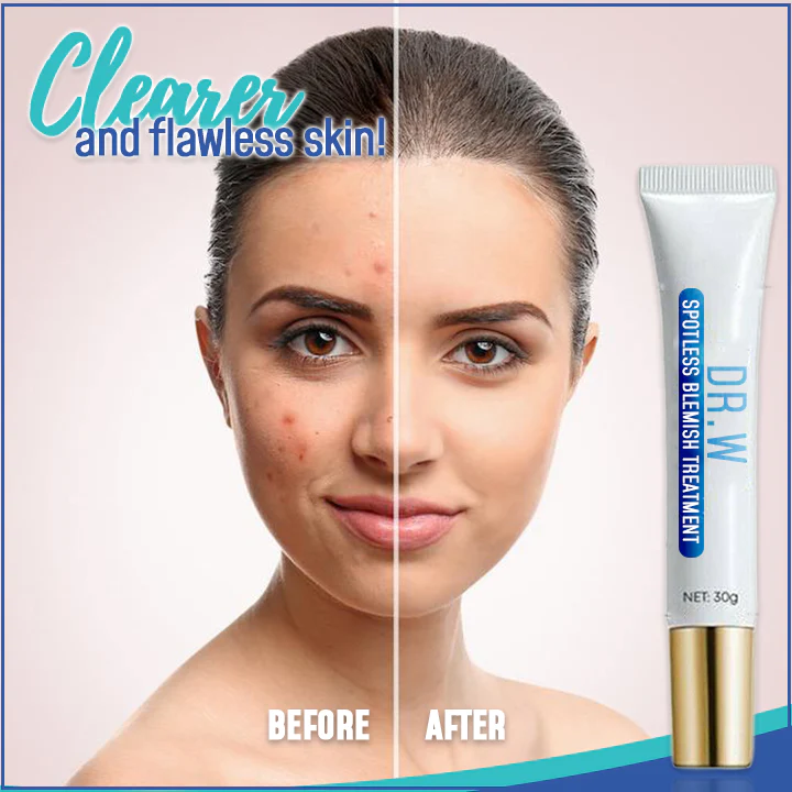 Dr. W Spotless Blemish Treatment - Image 6