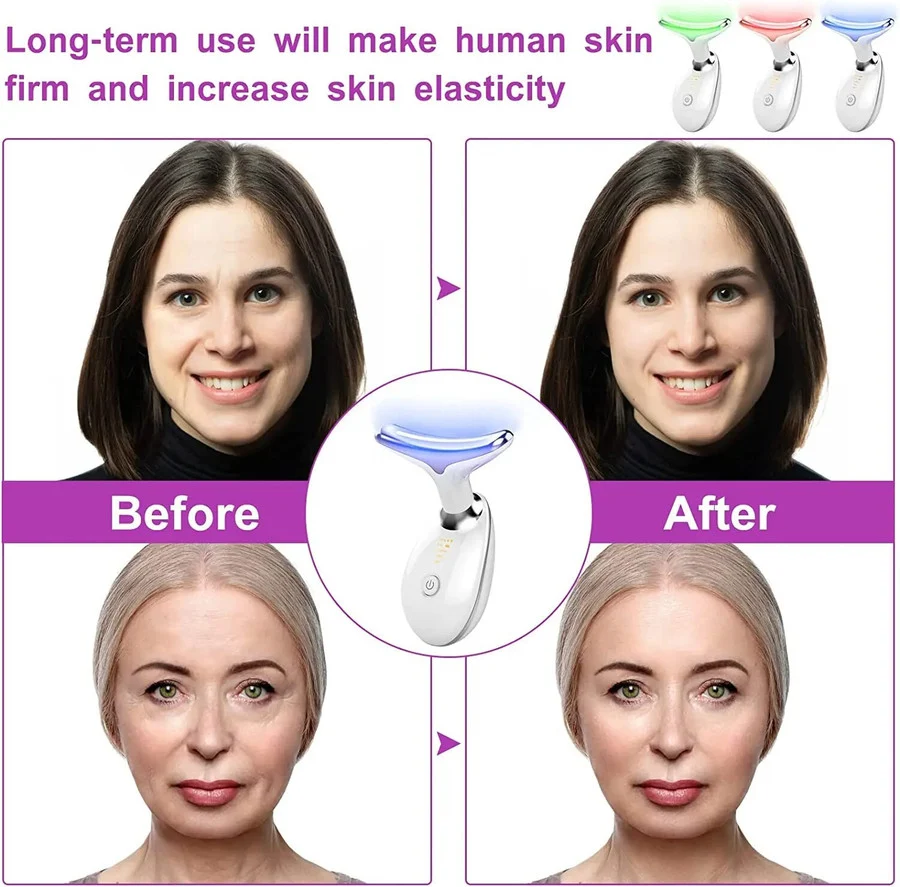 EMS FACE LIFTING MASSAGER - Image 3