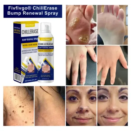 ChillErase Bump Renewal Spray - Image 2