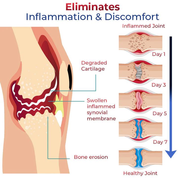 JointMax Discomfort and Inflammation Relief Foam - Image 2