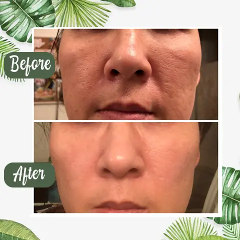 100% Natural Green Tea Deep Cleanse Mask - Image 5