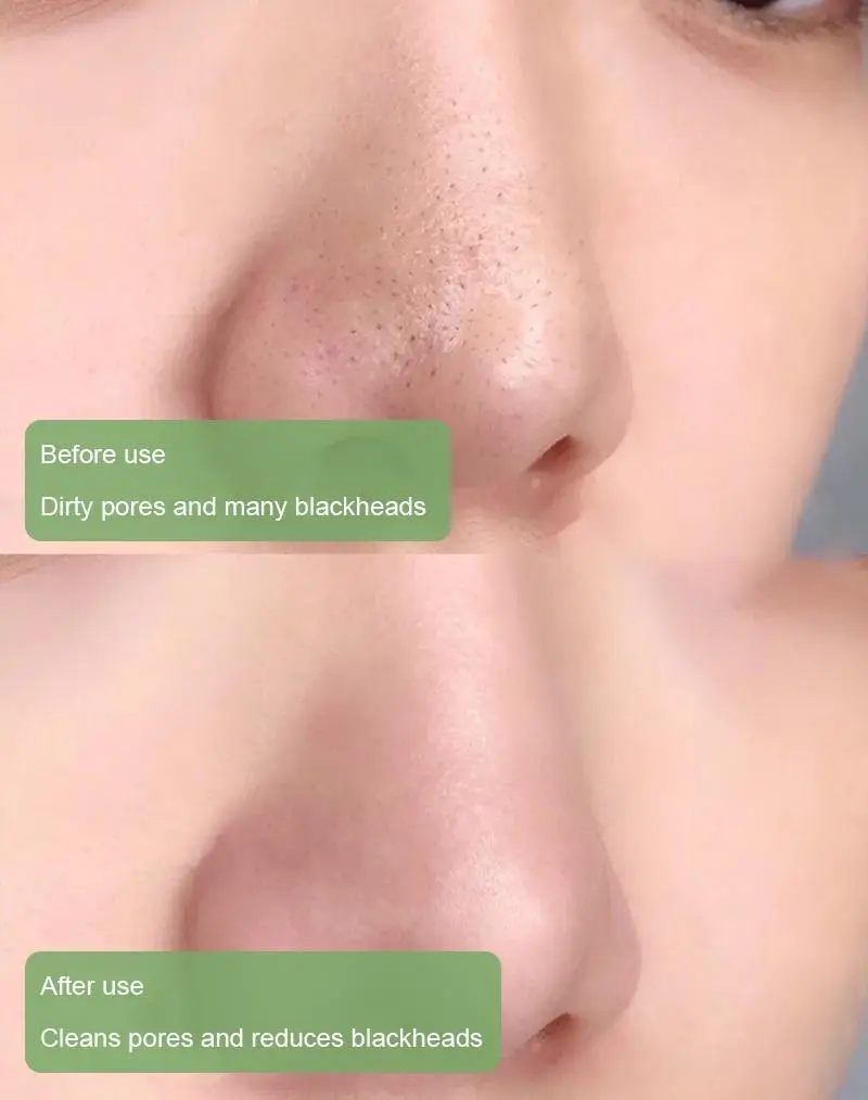 100% Natural Green Tea Deep Cleanse Mask - Image 6
