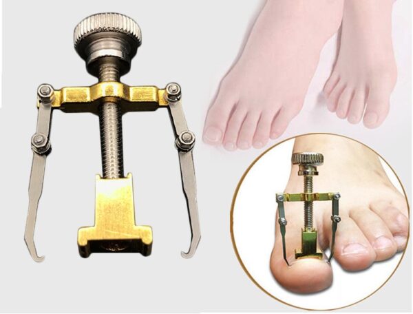 Ingrown Out - Image 4