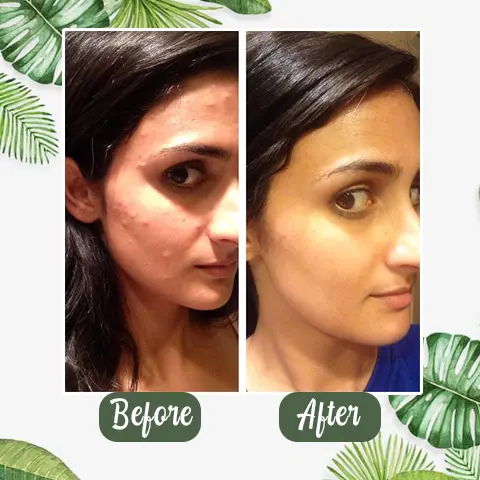 100% Natural Green Tea Deep Cleanse Mask - Image 3
