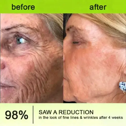Botox Vitamin A Retinol Anti-Wrinkle Firming and Lifting Cream Last Day for Limited Time 70 OFF - Image 17