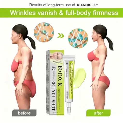 Botox Vitamin A Retinol Anti-Wrinkle Firming and Lifting Cream Last Day for Limited Time 70 OFF - Image 22