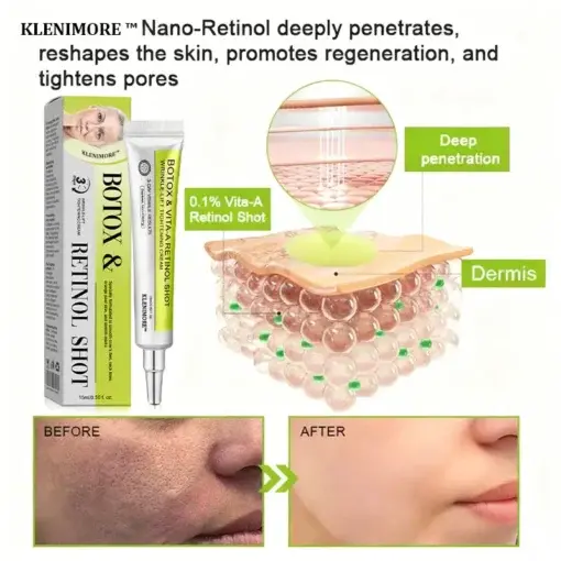 Botox Vitamin A Retinol Anti-Wrinkle Firming and Lifting Cream Last Day for Limited Time 70 OFF - Image 24