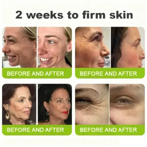Botox Vitamin A Retinol Anti-Wrinkle Firming and Lifting Cream Last Day for Limited Time 70 OFF - Image 3