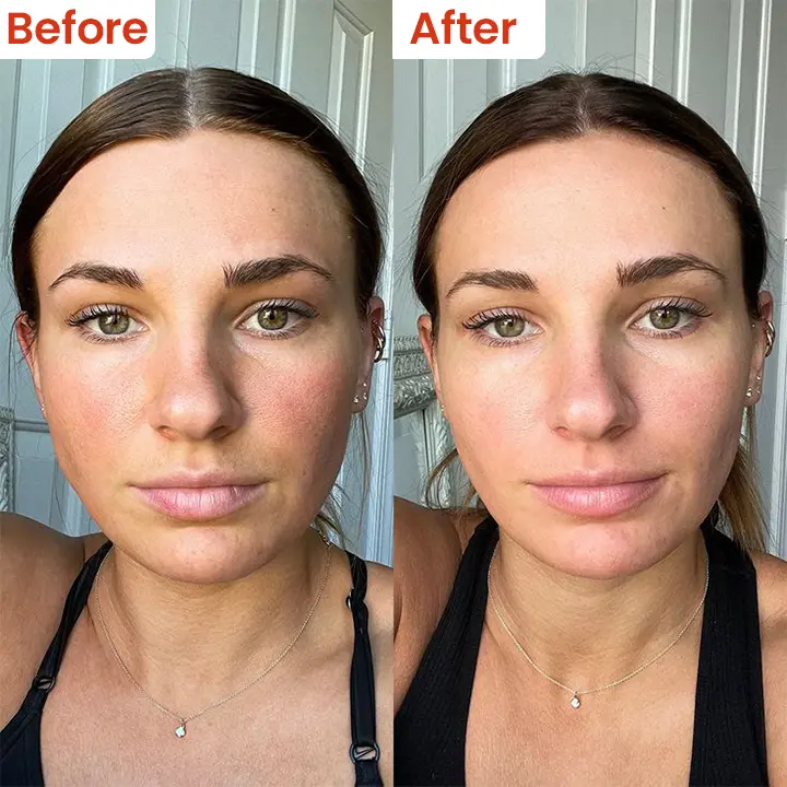Cheilitis Cream - Image 10