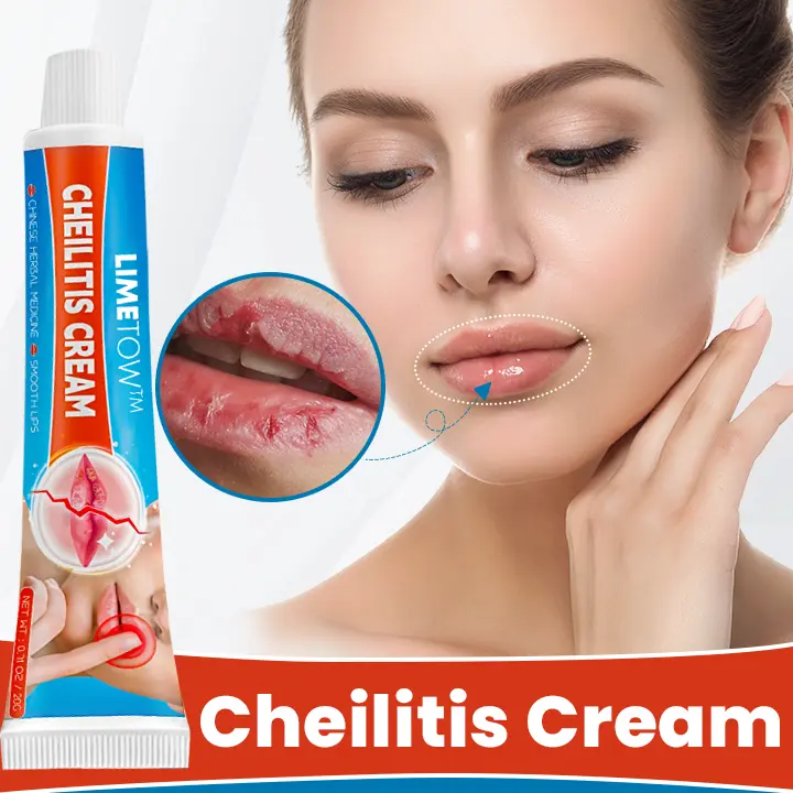Cheilitis Cream - Image 2