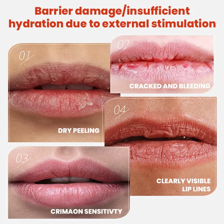 Cheilitis Cream - Image 8