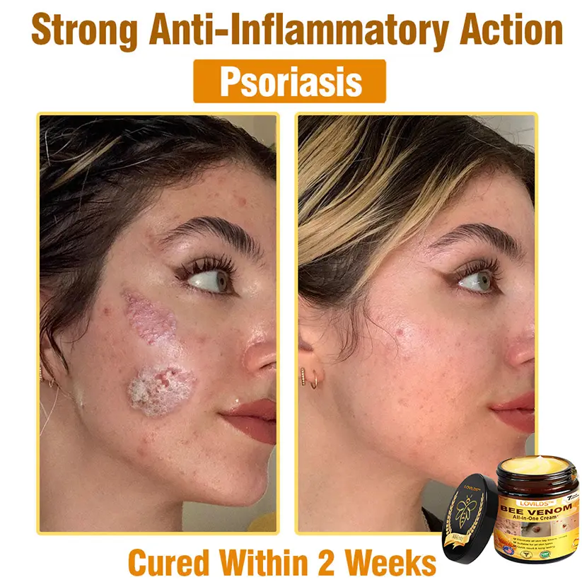 Bee Venom All-in-One Cream - Image 6