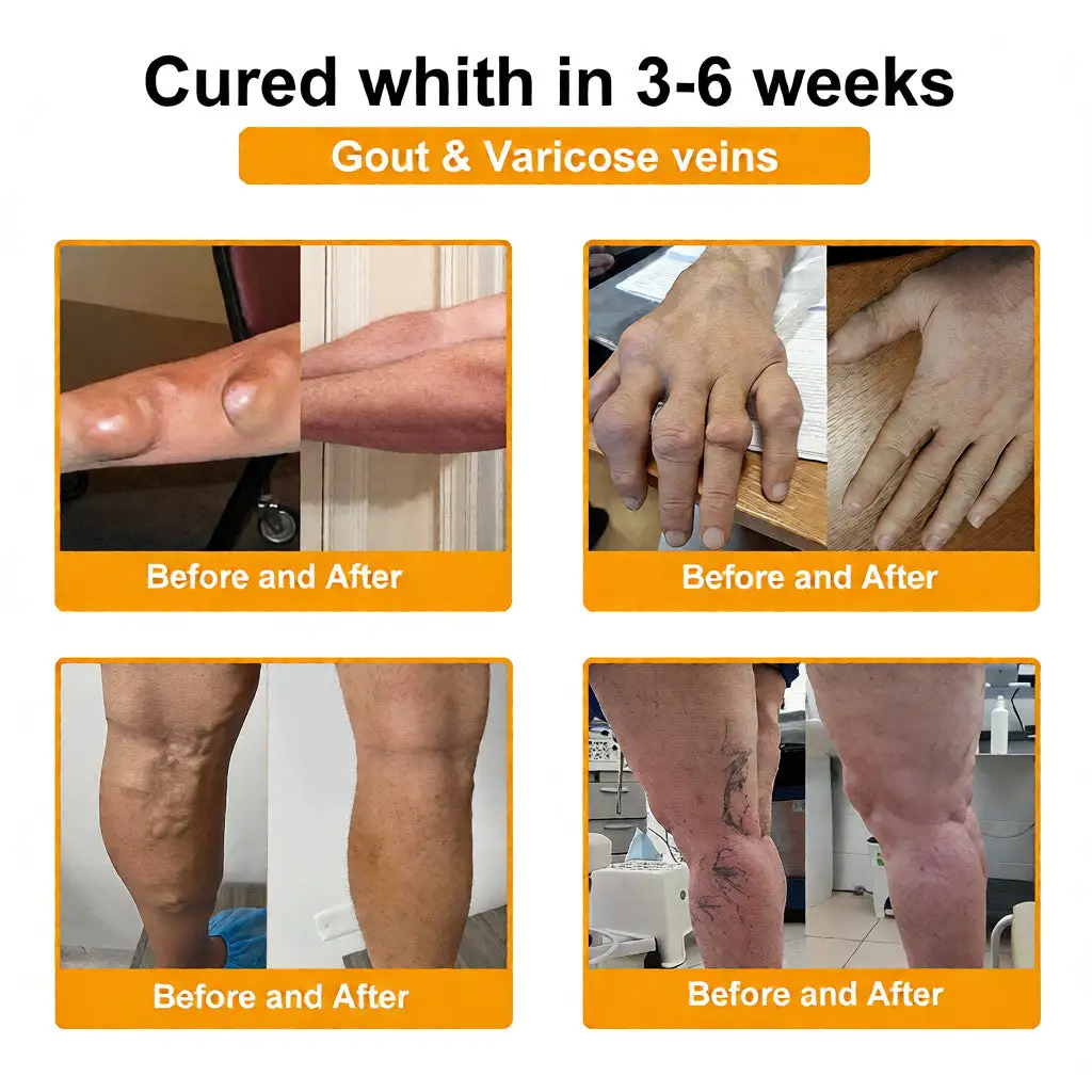 Bee Venom Pain-Relief Bone Healing Cream - Image 5