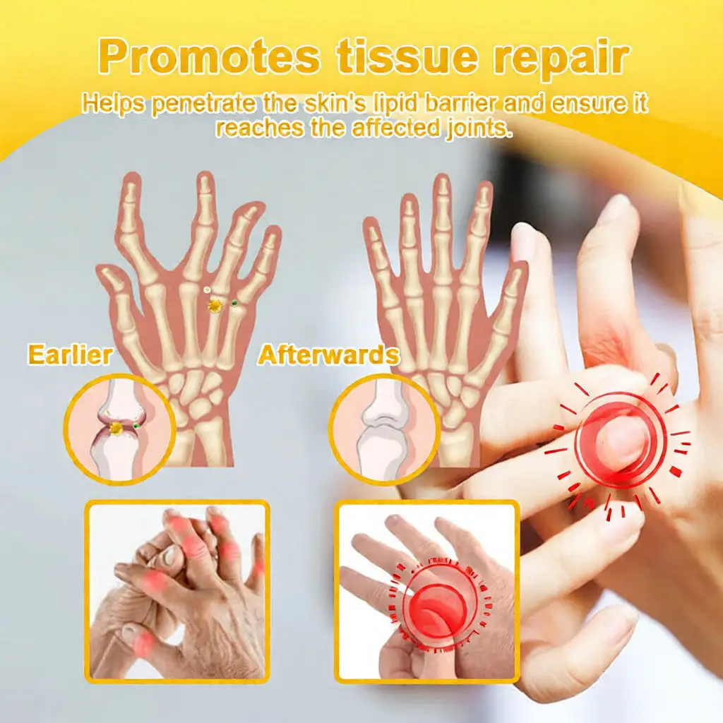 Bee Venom Pain-Relief Bone Healing Cream - Image 12