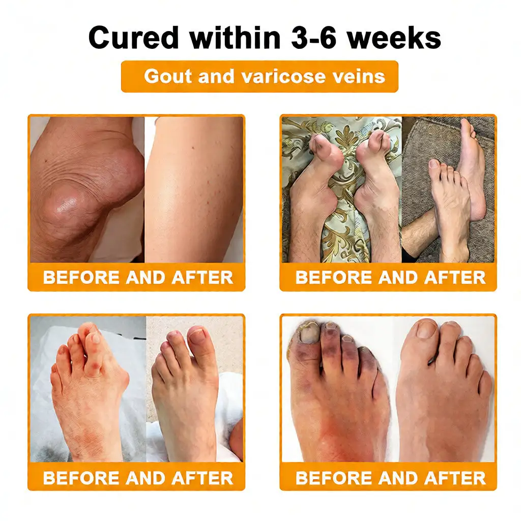 Bee Venom Pain-Relief Bone Healing Cream - Image 3