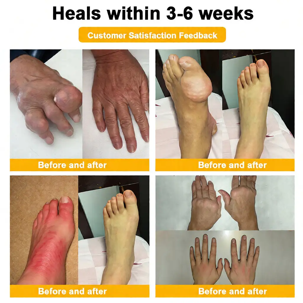 Bee Venom Pain-Relief Bone Healing Cream - Image 4