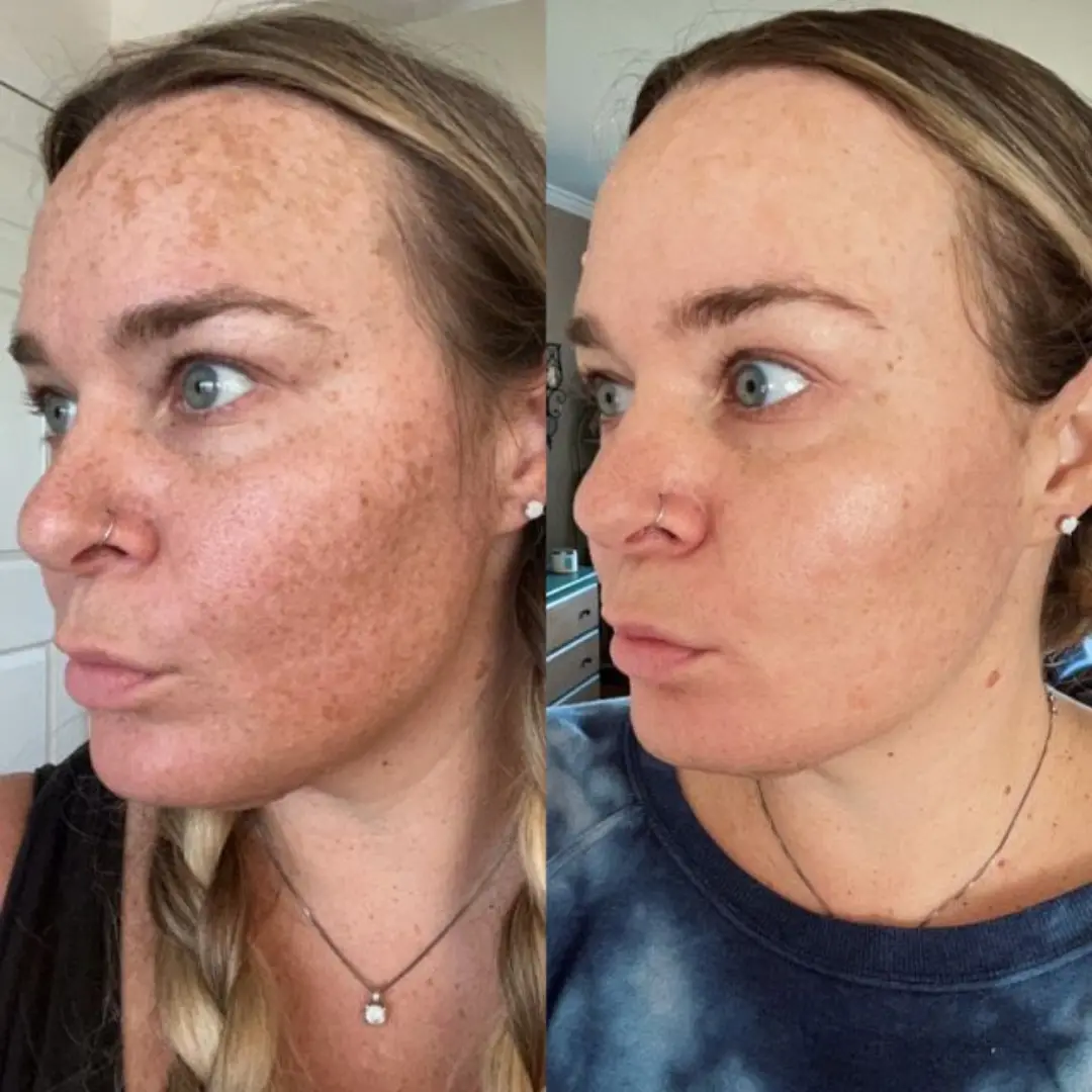Facial Cream with 7% Arbutin + 4% Tranexamic Acid - Image 3