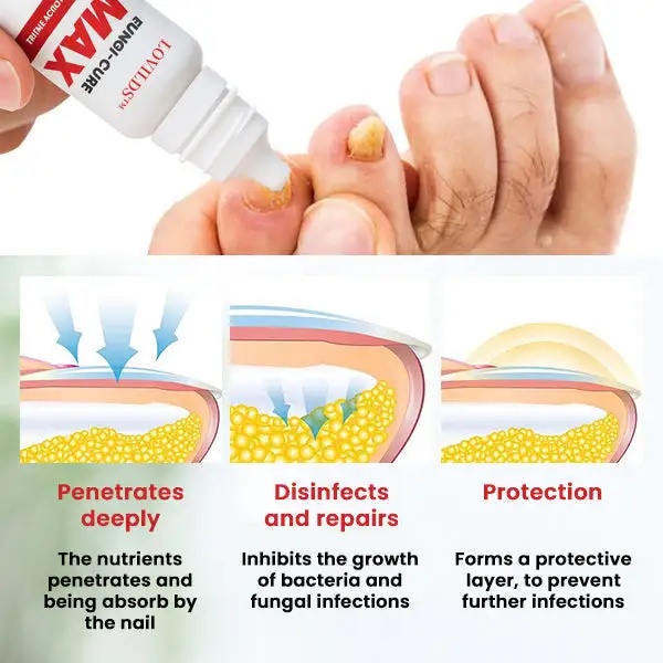 Fungi-Cure Max Fast-Acting Relief for Fungal Nail Infections - Image 5