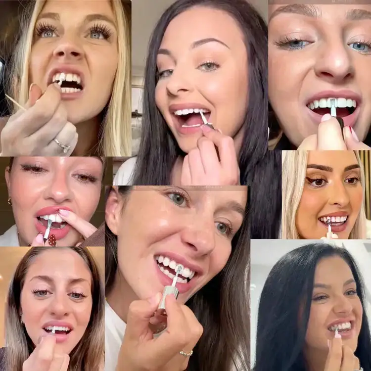 Tooth Polish-Brighten your smile naturally - Image 4