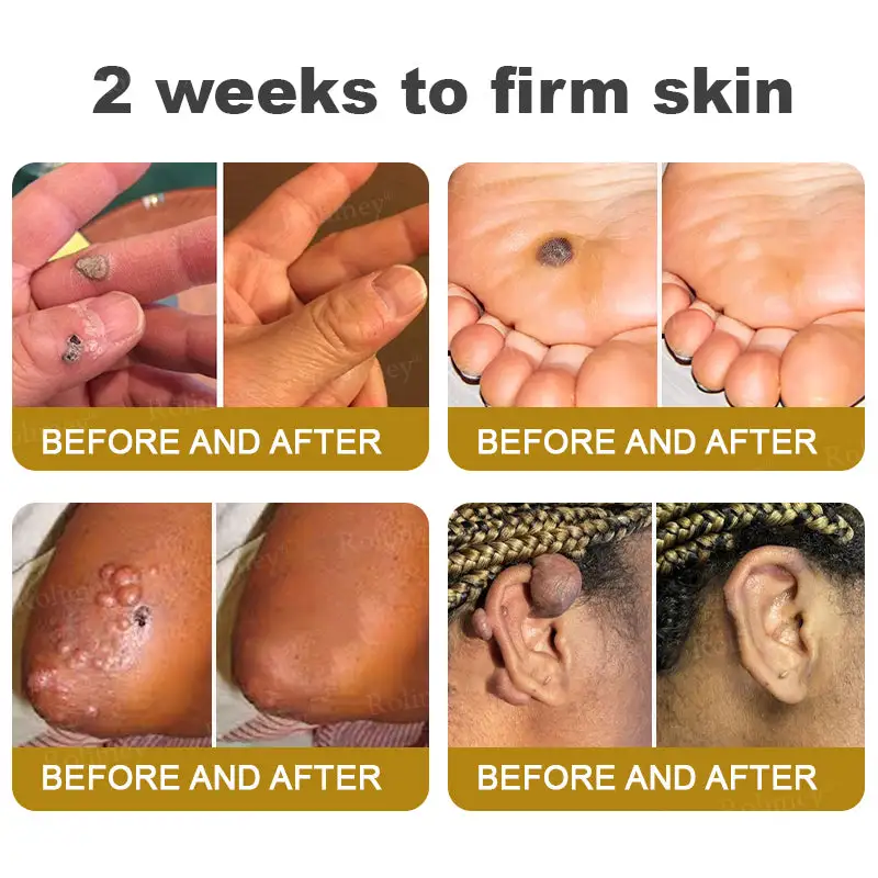 Bee Venom Skin Comprehensive Cream - Image 5