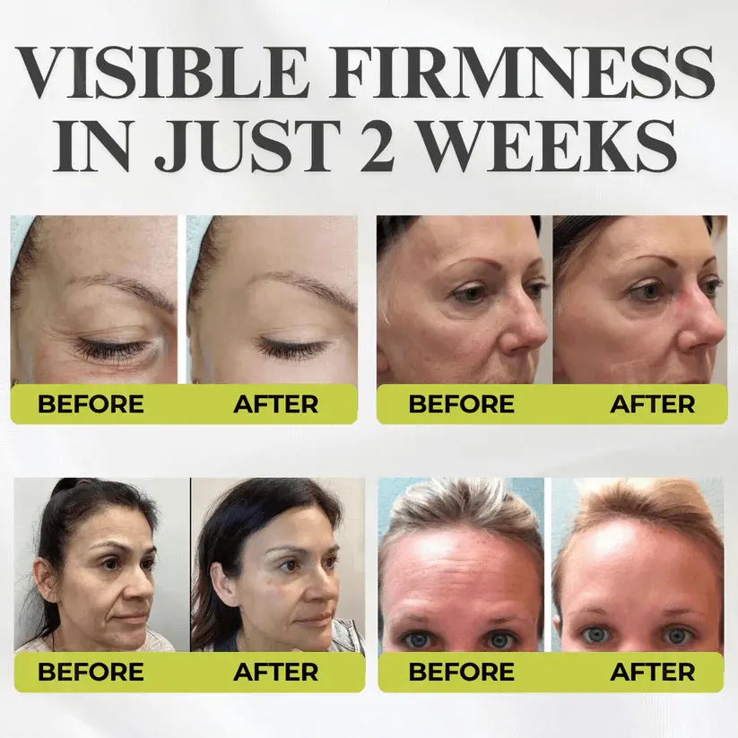 Botox & Vita-A Retinol Shot Wrinkle-Lift Tightening cream - Image 8