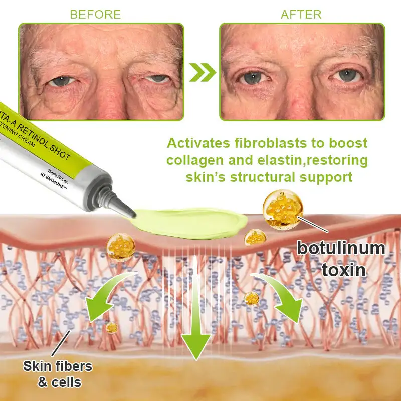 Botox Vitamin A Retinol Anti-Wrinkle Firming and Lifting Cream - Image 25