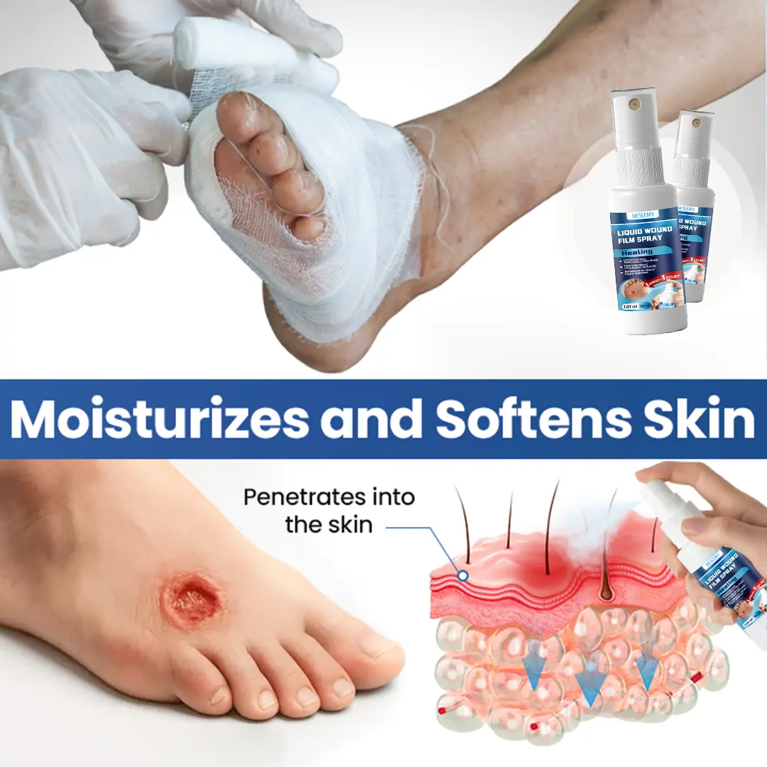 Liquid Wound Film Spray - Image 9