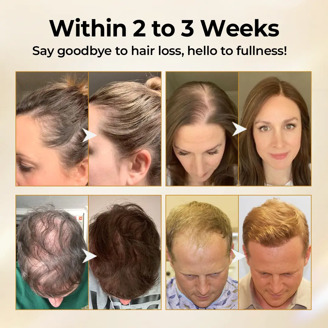 CollagenGrow Peptides Hair Growth Spray - Image 4