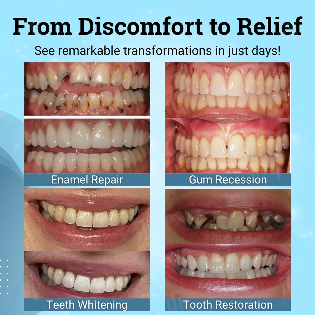 Non-Surgical Gum "Suture" Gel - Image 2