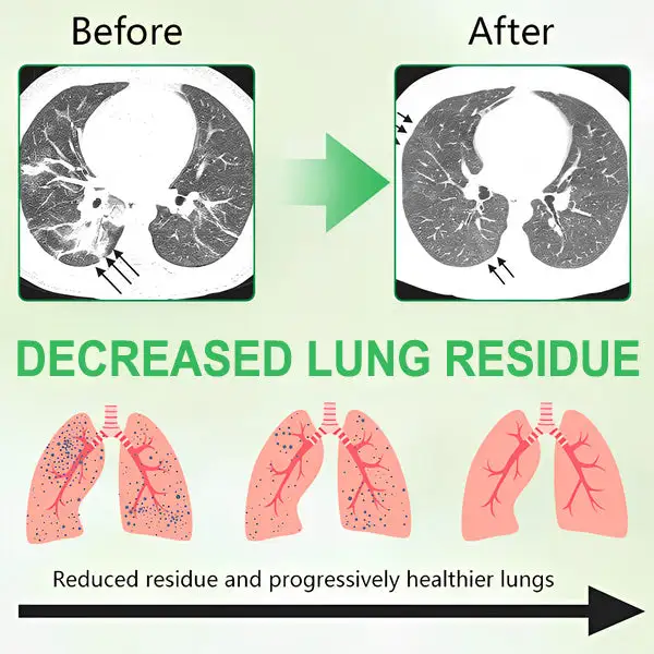 3X Concentrated Mullein Lung Cleanse Spray — Helps Soothe Throat Discomfort & Support Clearer Breathing - Image 3