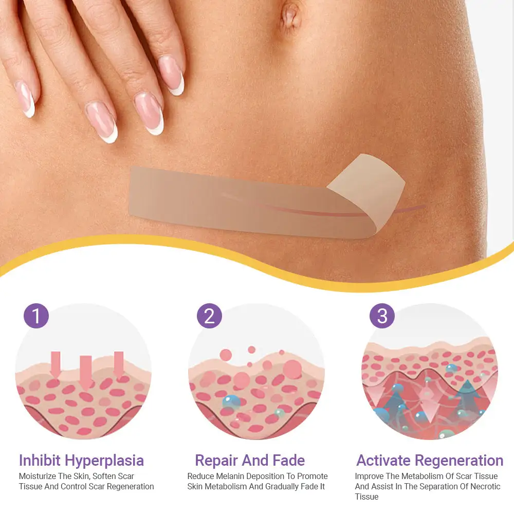 Hyaluronan Nano Microneedle Repair Tape - Image 8